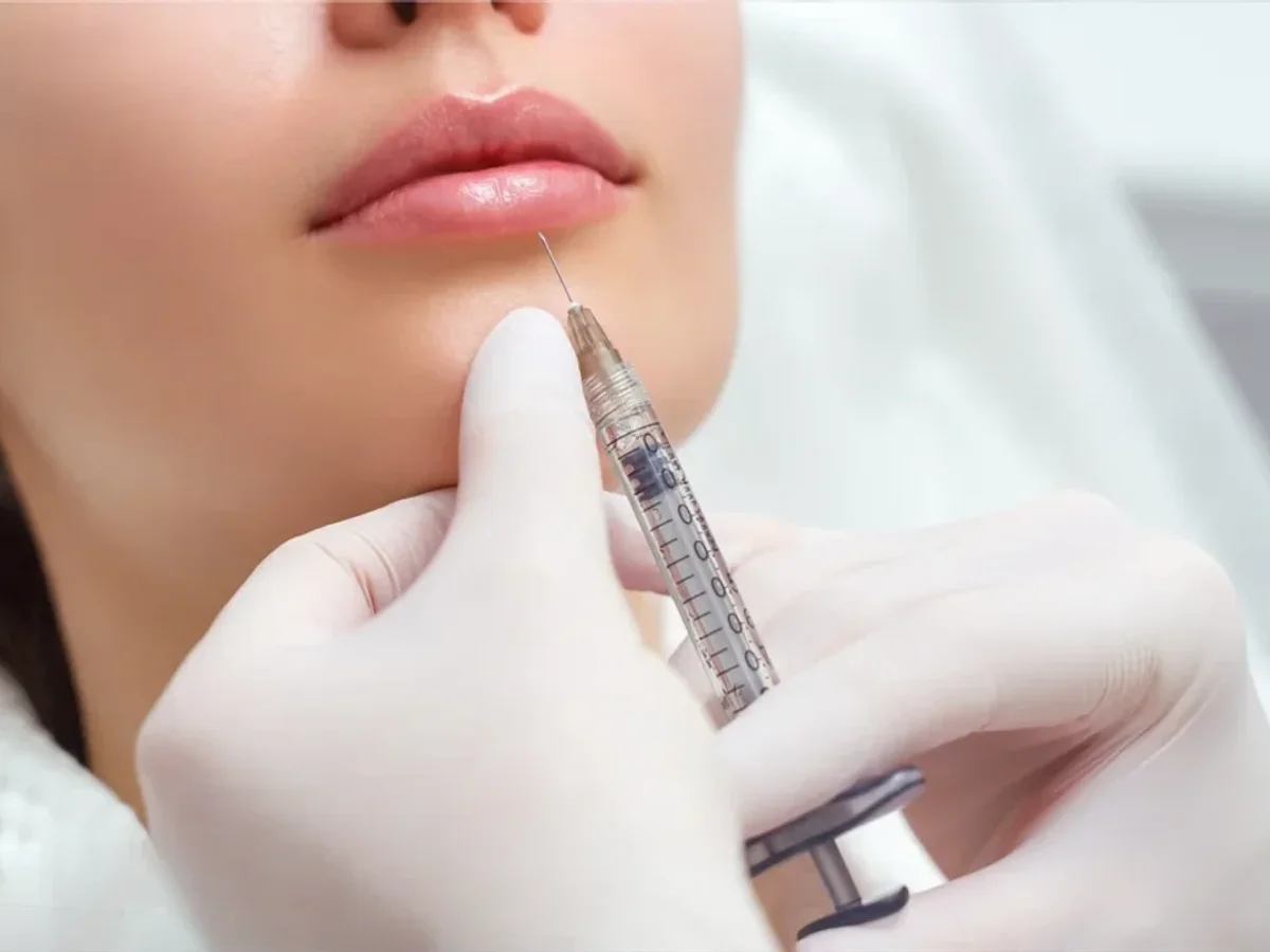 Dermal Fillers & Lip Enhancement